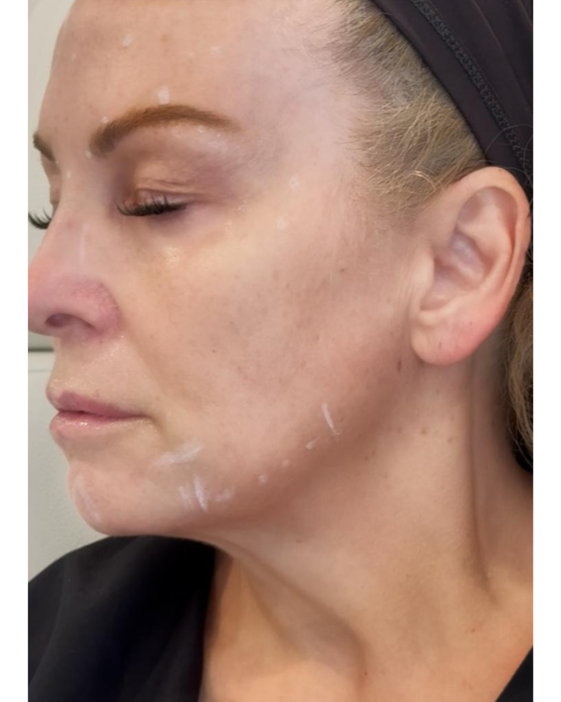 Nefertiti Lift